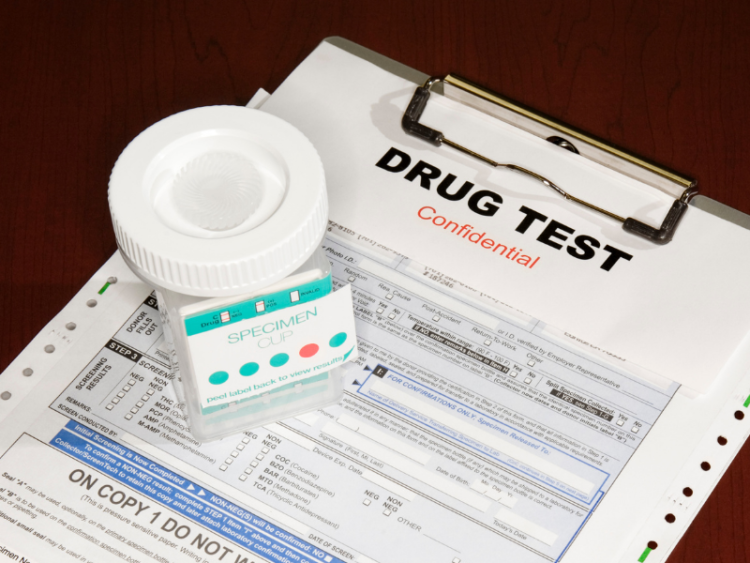 Drug test on a clip board with specimen cup